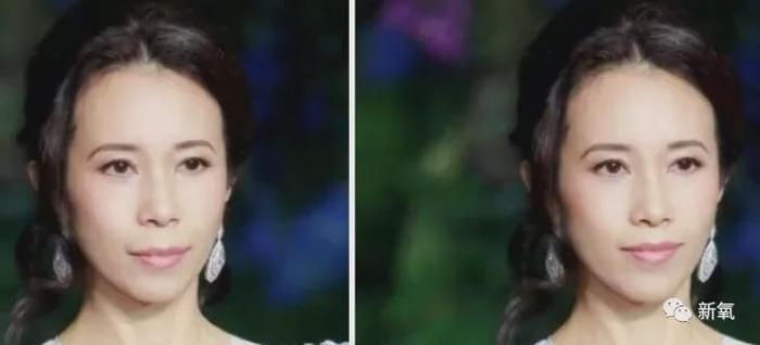 娱乐圈第一代人造美女，因为乱填充翻车了？