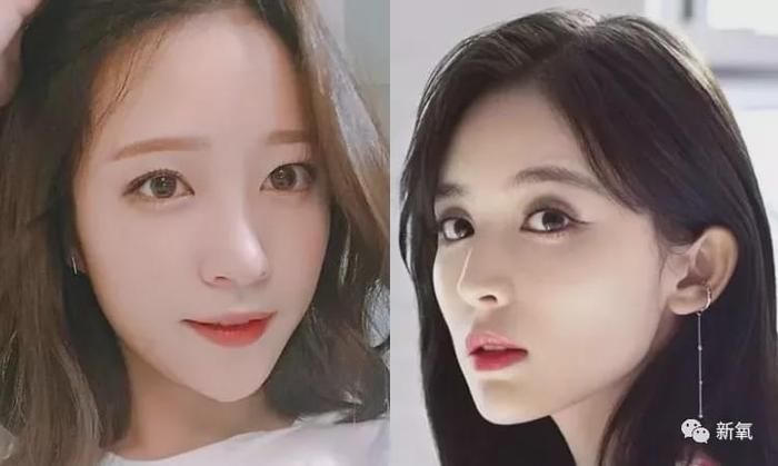 娱乐圈第一代人造美女，因为乱填充翻车了？
