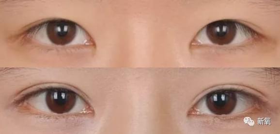 娱乐圈第一代人造美女，因为乱填充翻车了？