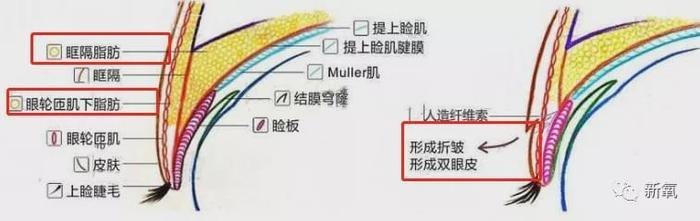 娱乐圈第一代人造美女，因为乱填充翻车了？