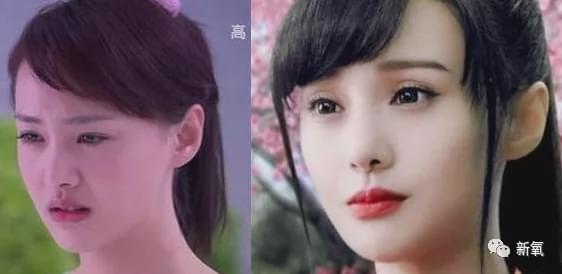 娱乐圈第一代人造美女，因为乱填充翻车了？