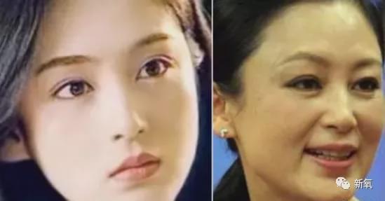 娱乐圈第一代人造美女，因为乱填充翻车了？