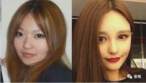 娱乐圈第一代人造美女，因为乱填充翻车了？