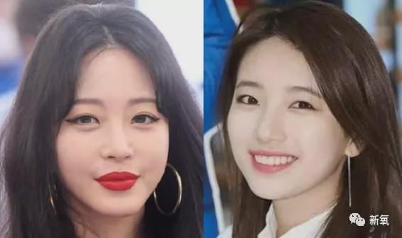 娱乐圈第一代人造美女，因为乱填充翻车了？
