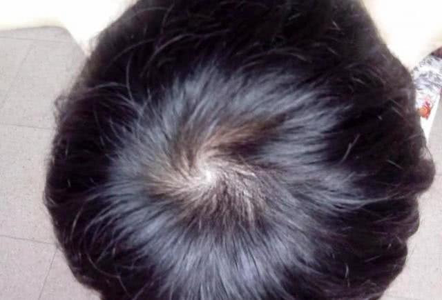 你知道头旋的寓意吗?男孩头上7个旋,网友:太难为造型师了