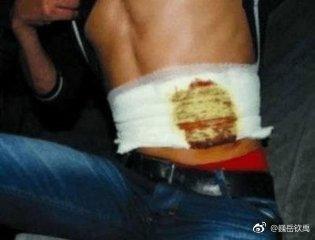 当年割肾买手机的小伙现在怎么样了？