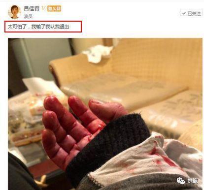 放过乔任梁吧，他自杀不是为了让你们拿来给自己卖惨搏版面用的！
