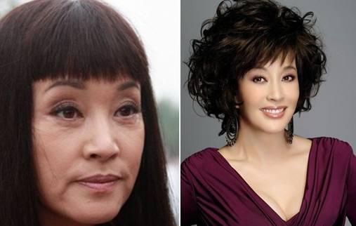 郑爽为爱整容，乐基儿隆胸，何洁柳岩变美，她整容变残被骂惨