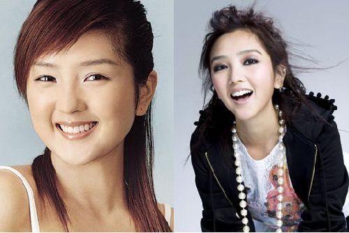郑爽为爱整容，乐基儿隆胸，何洁柳岩变美，她整容变残被骂惨