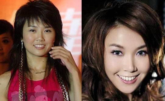 郑爽为爱整容，乐基儿隆胸，何洁柳岩变美，她整容变残被骂惨