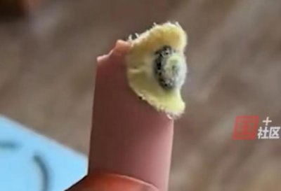 ​“吓人”！女子称双汇火腿肠里有像眼睛似的异物！客服：已安排核实处理！不是