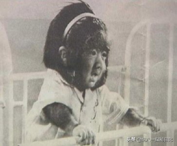 ​于震寰：出生一身长毛，与10位护士相亲被拒，42岁终娶90后娇妻