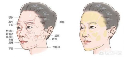 什么是玻尿酸玻尿酸的作用(什么是玻尿酸夏凉被)-第7张图片-