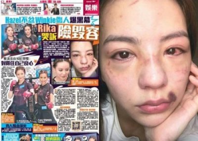真人秀玩出火,香港女星被暴打毁容,导致恐有永久性伤害!