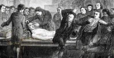 ​1800 年代真实的弗兰肯斯坦复活死尸实验