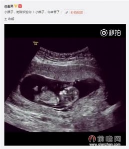 ​伊能静老公秦昊证实怀孕 前夫庾澄庆隔空送祝福