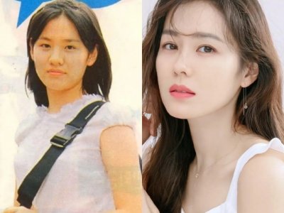 ​孙艺珍整容前（孙艺珍被质疑整容痕迹明显起热议）