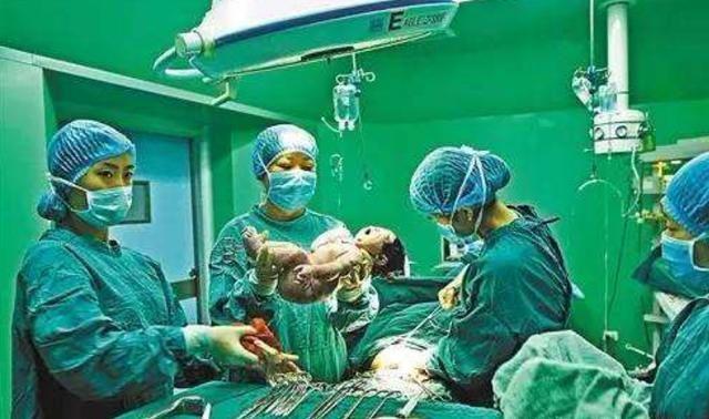 剖腹产很轻松?别想得太简单了,光剖这一步就要剖开7层