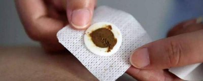 ​三伏贴能不能吹风扇 贴三伏贴可以吹电风扇吗