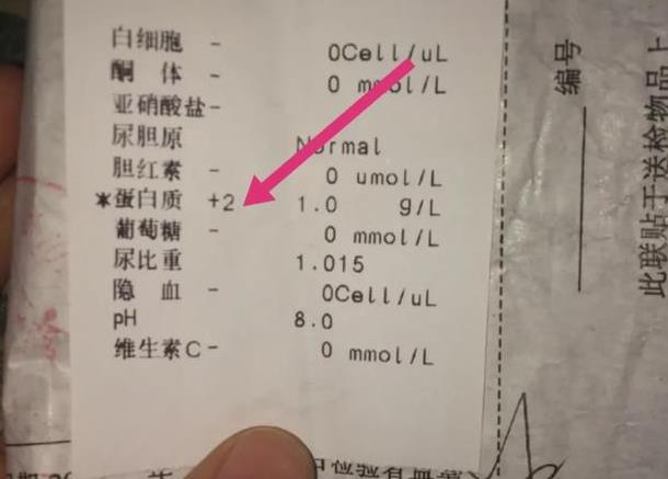 肾不好的人有什么表现 人肾不好身体有什么反应 肾不好的人有什么表现 人肾不好身体有什么反应