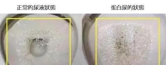 肾不好的人有什么表现 人肾不好身体有什么反应 肾不好的人有什么表现 人肾不好身体有什么反应