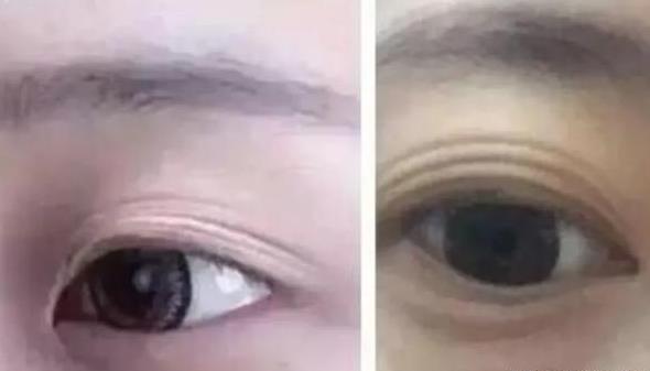 肾不好的人有什么表现 人肾不好身体有什么反应 肾不好的人有什么表现 人肾不好身体有什么反应